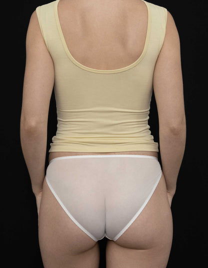 Recline Bateau Sleeveless Limoncello